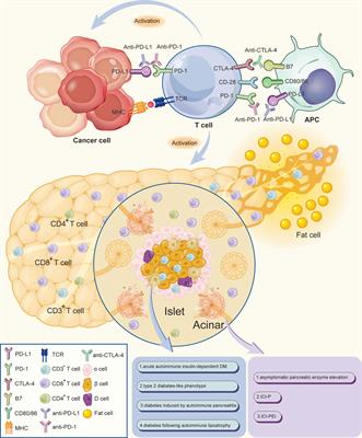 Immunotherapy-Associated Pancreatic Adverse Events: Current Understanding of Their Mechanism, Diagnosis, and Management